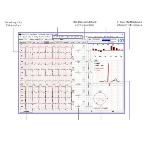 Cardiac Stress Test System Vega 204